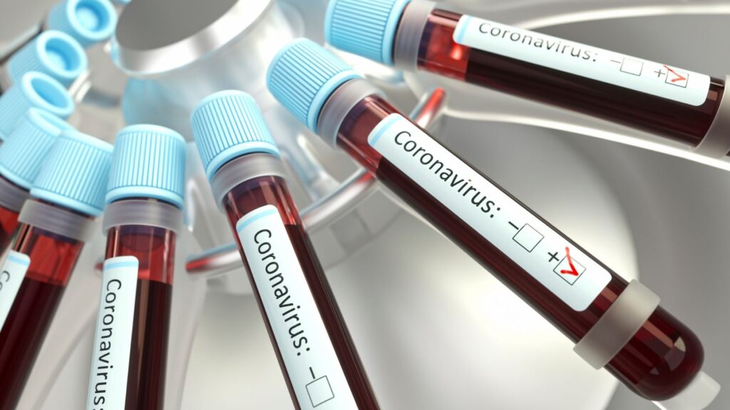 Joking about coronavirus: Where's the line when everyone's on edge?